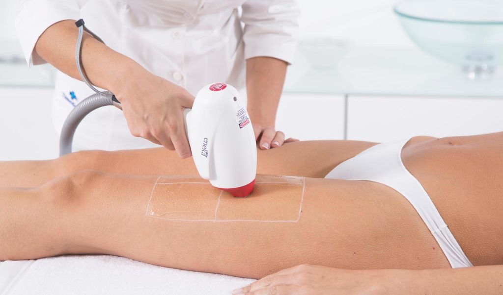 How Does Laser Hair Removal Work?