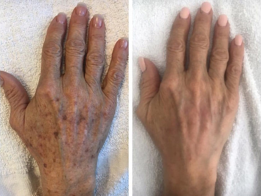 before-after-3