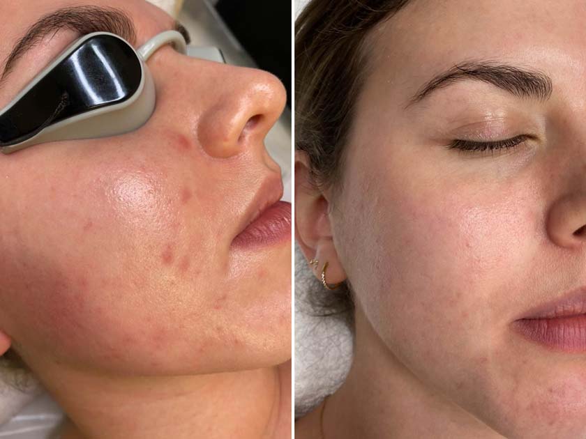 before-after-4
